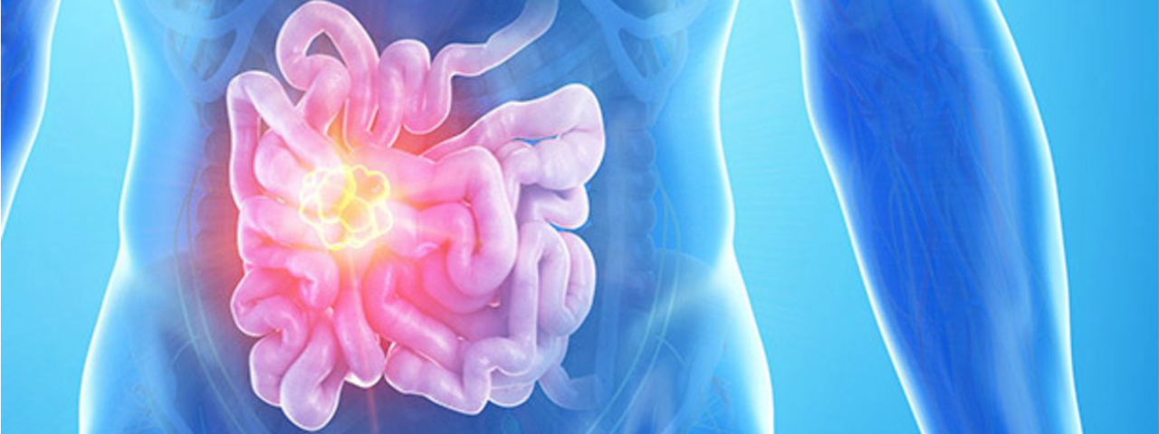 Darmkrebsmonat März Darmkrebsmonat März